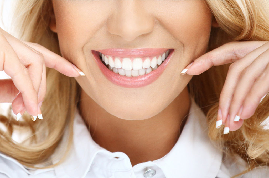perfect smile with dermal fillers