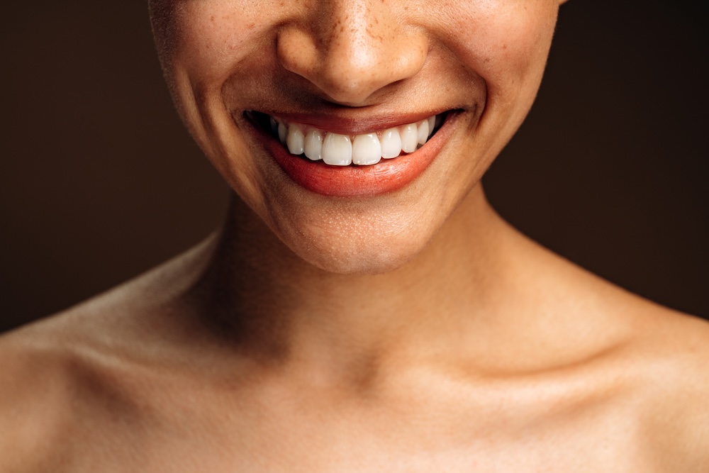Dark background with up close photo of woman's smile, proudly showing her whiter, straighter teeth after getting cosmetic dentisry in Waxhaw