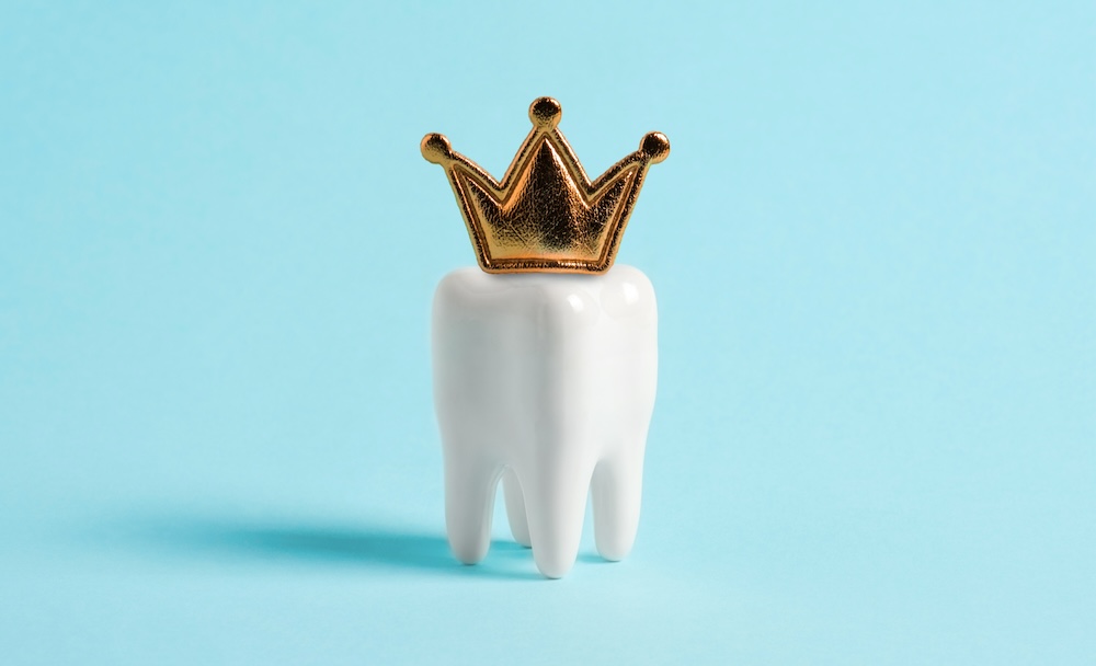 Photo of tooth with a gold crown on it to show fun imagery of dental crowns near Waxhaw